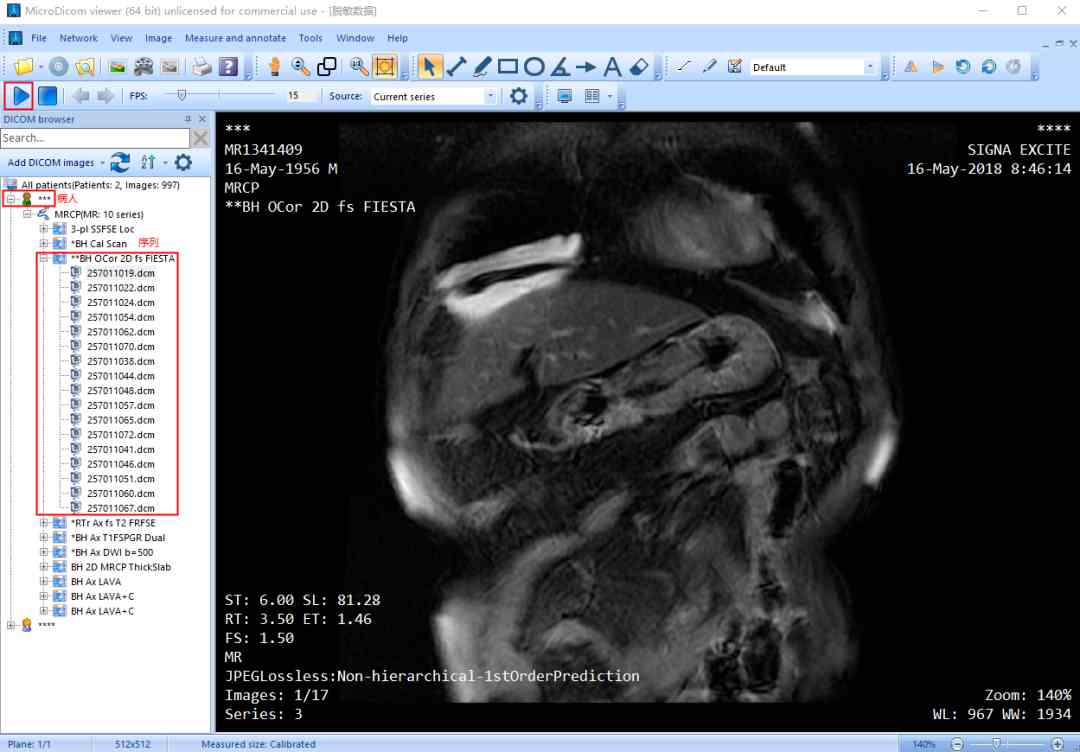 读取影像时延过高